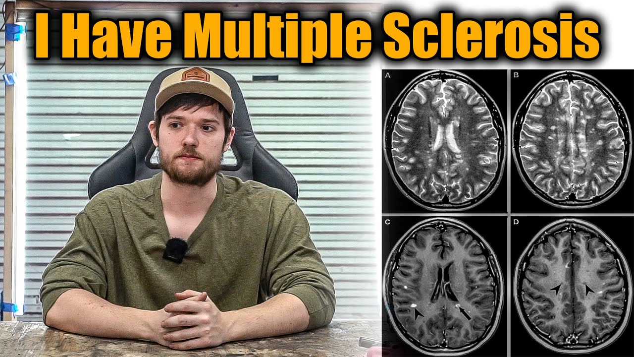 So, I Have Multiple Sclerosis (MS)