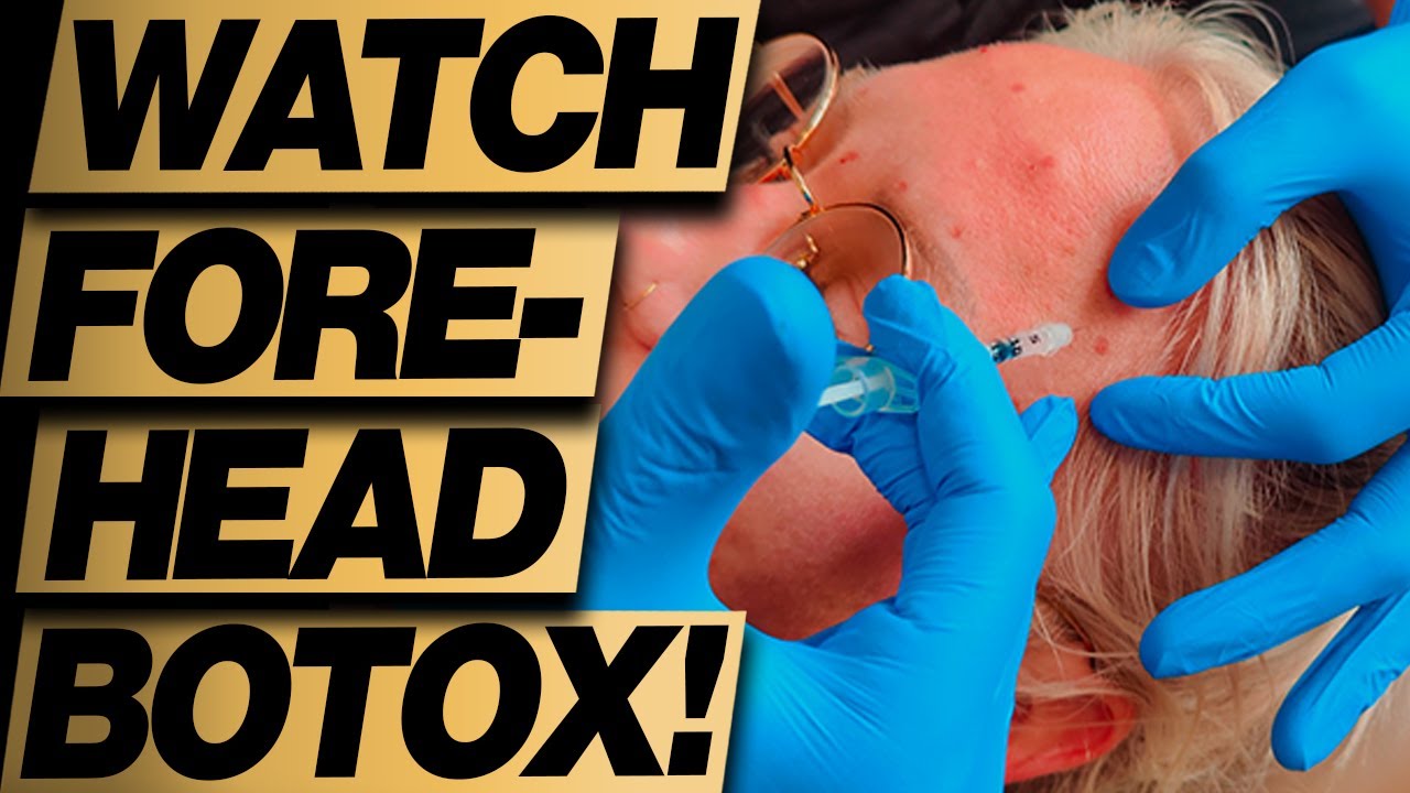 Botox Injections Technique Forehead Wrinkles