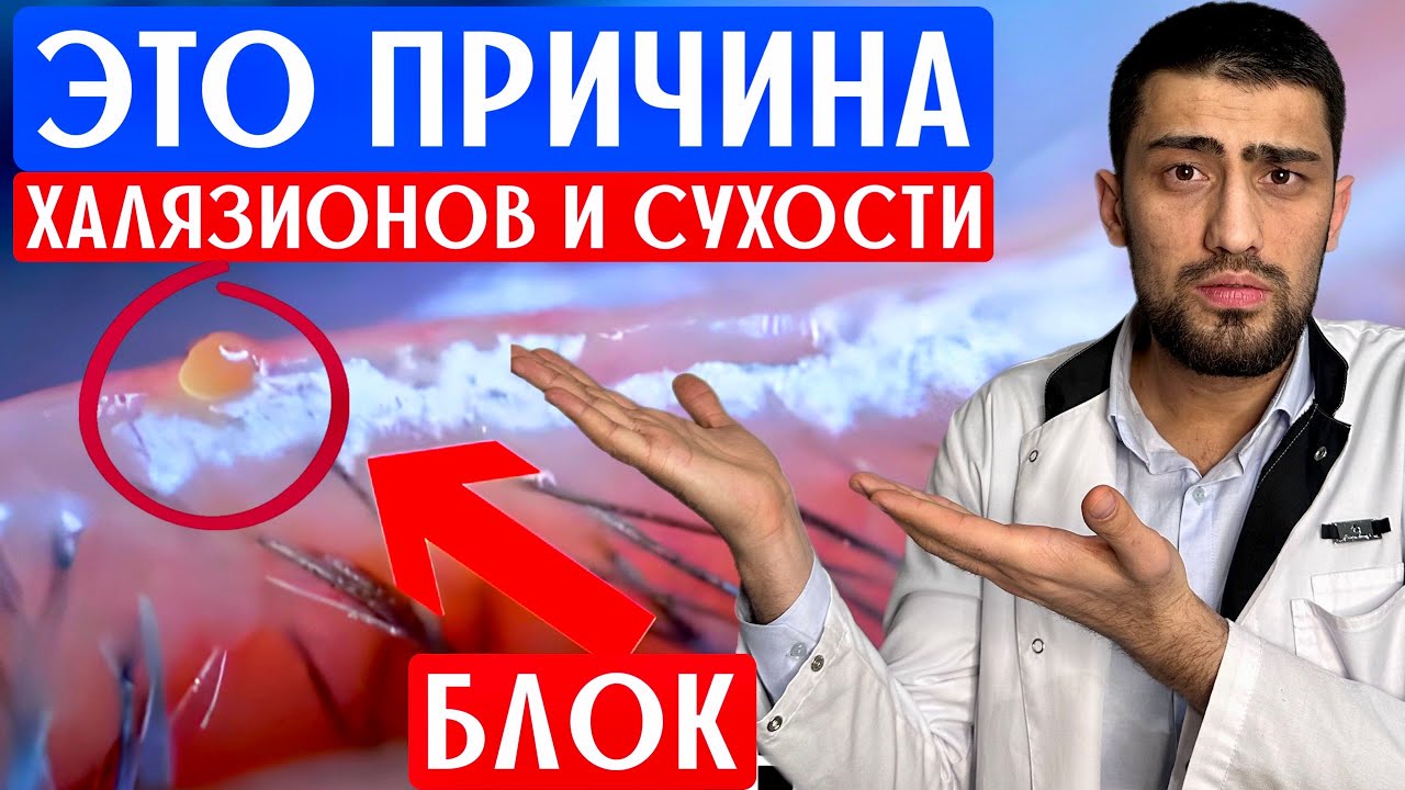 Самый лучший способ от халязионов, ячменей и сухости в глазах. Массаж век от офтальмолога.