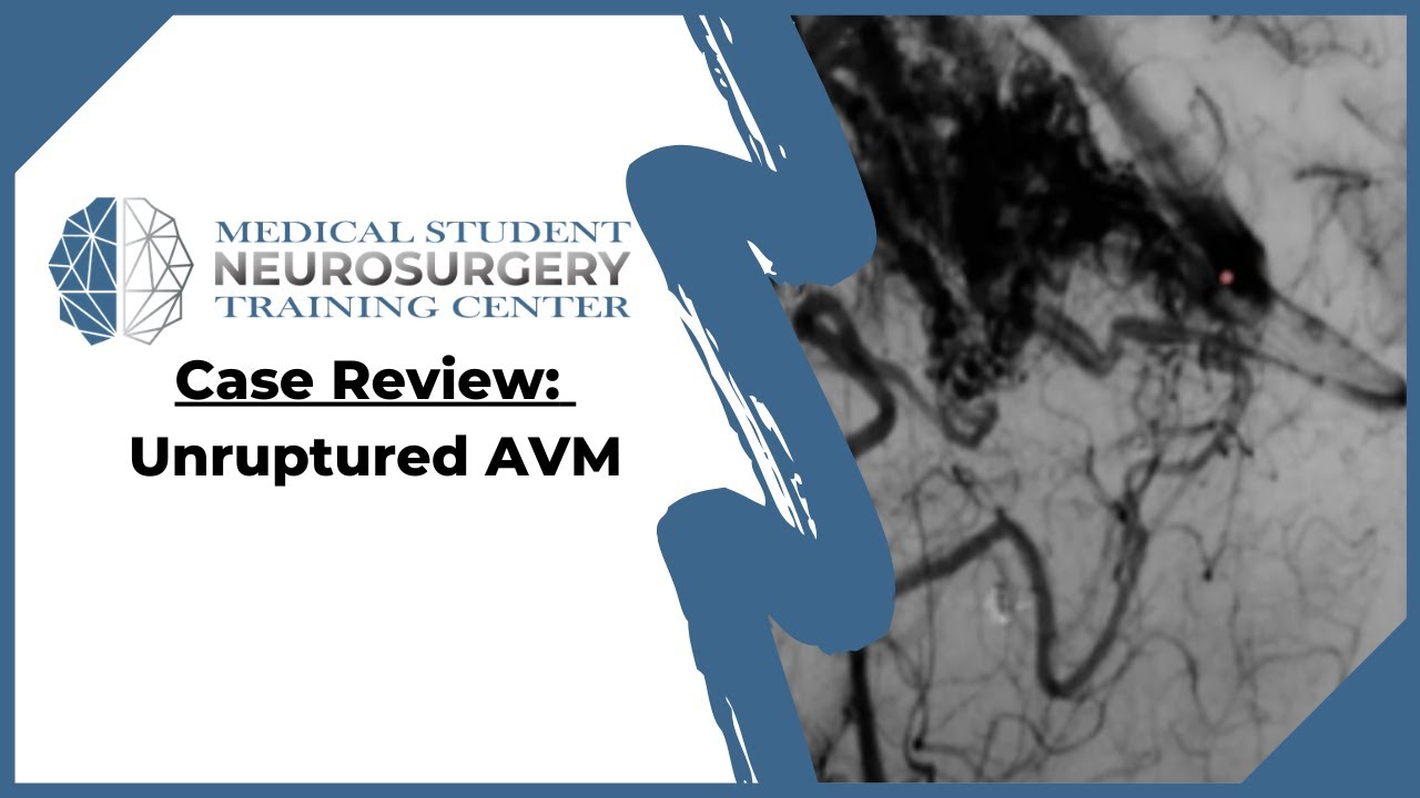 Case Review: Unruptured AVM
