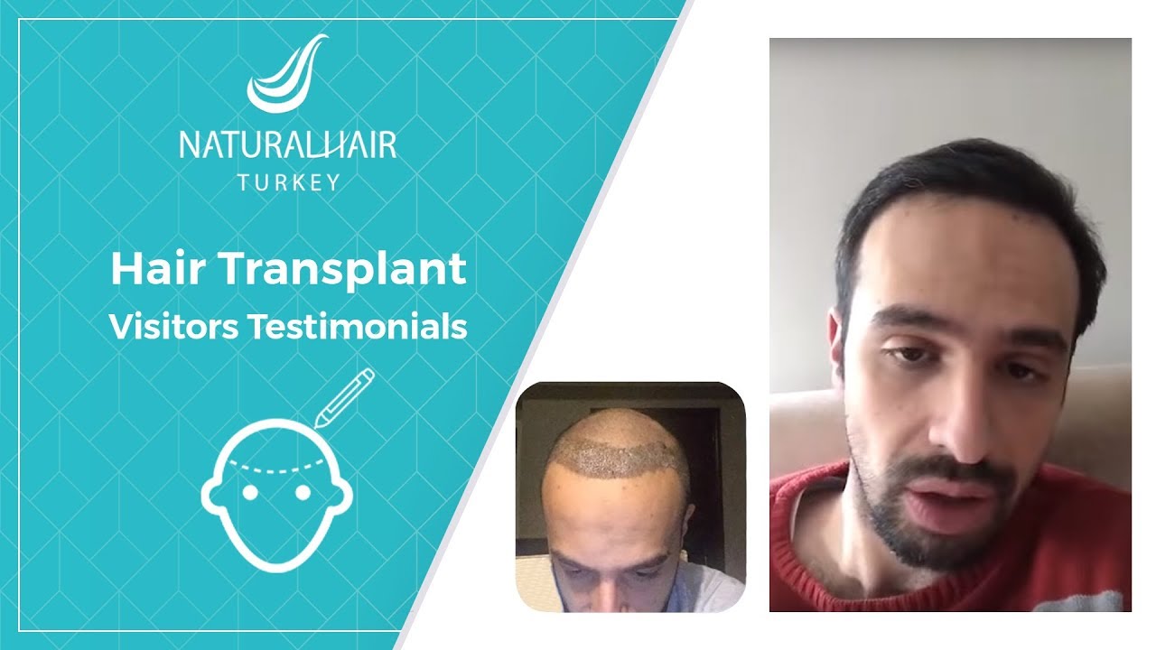 أفضل نتيجة لتجربة زراعة الشعر يوم بعد يوم