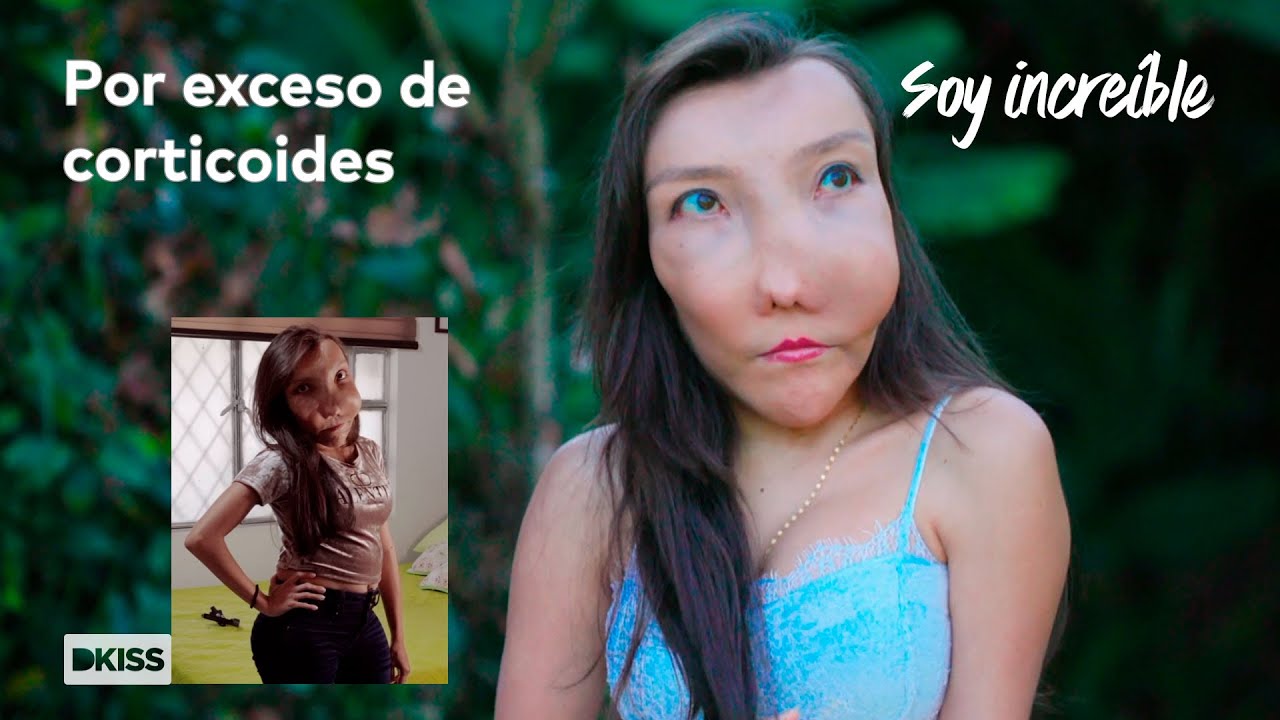 La “enfermedad silenciosa” de Leidy| Soy increíble
