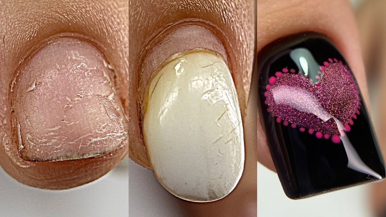 Наращивание подробно на ВЕРХНИЕ ФОРМЫ💅Ногти курильщика😐Отодранное покрытие / Маникюр