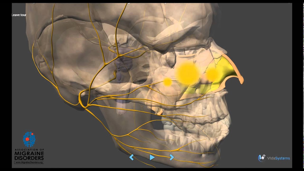 Migraine Pathophysiology - In depth