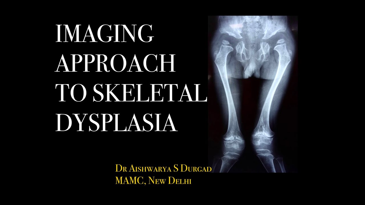 IMAGING APPROACH TO SKELETAL DYSPLASIA |Skeletal survey l Types of dysplasia l X-rays l