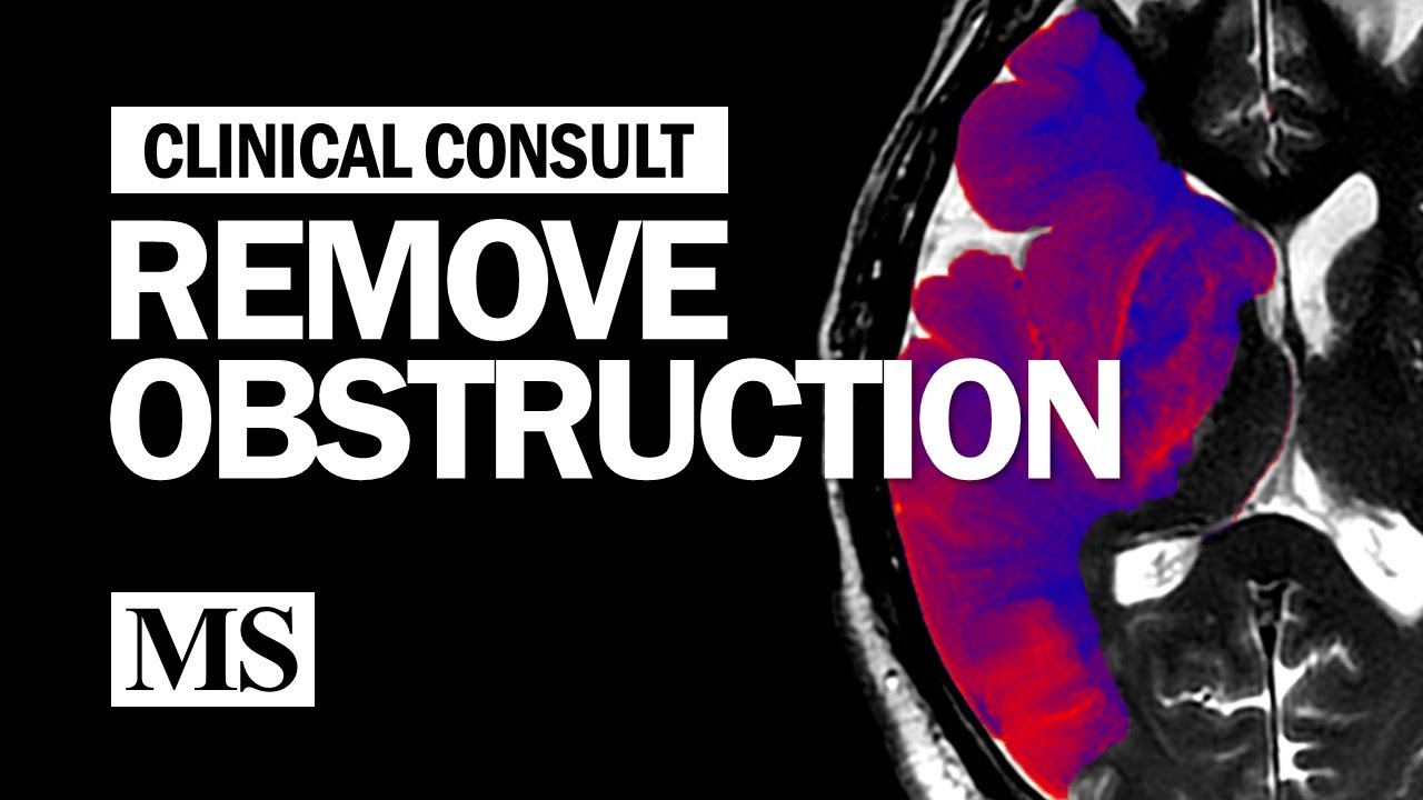 Clinical Consult: Remove The Obstruction