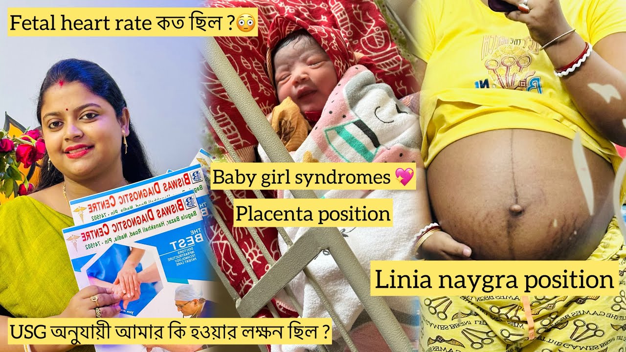 কিভাবে Usg Report দেখেই বুঝতে পেরেছিলাম মেয়ে হবে ? সত্যিটা বলেই দিলাম 😃#pregnancytips #motherhood