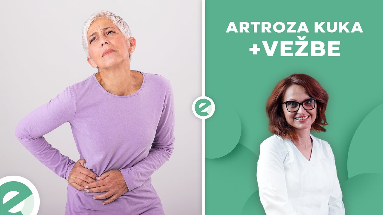 Artroza kuka! Šta je? Simptomi? Lecenje! |  5 VEZBI ZA KUK | FIZIJATAR | ORDINACIJA EXPERTA |