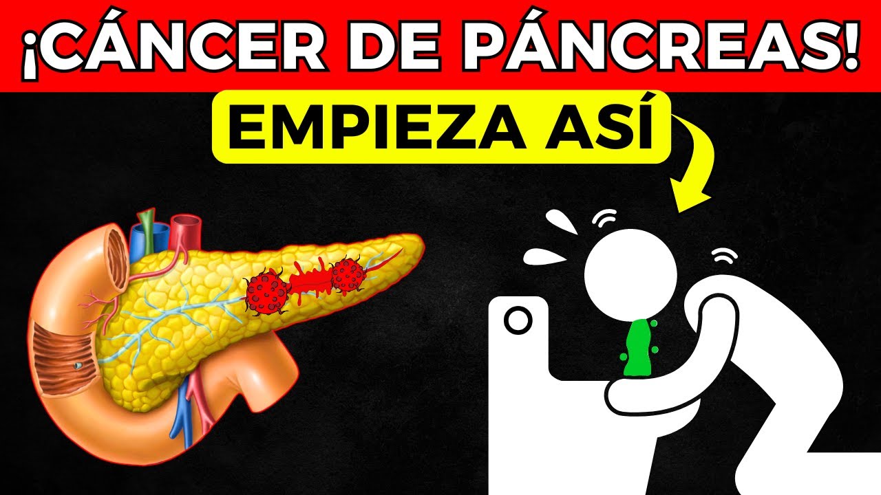 ¡CÁNCER DE PÁNCREAS! NUNCA ignore ESTOS 10 signos de alarma