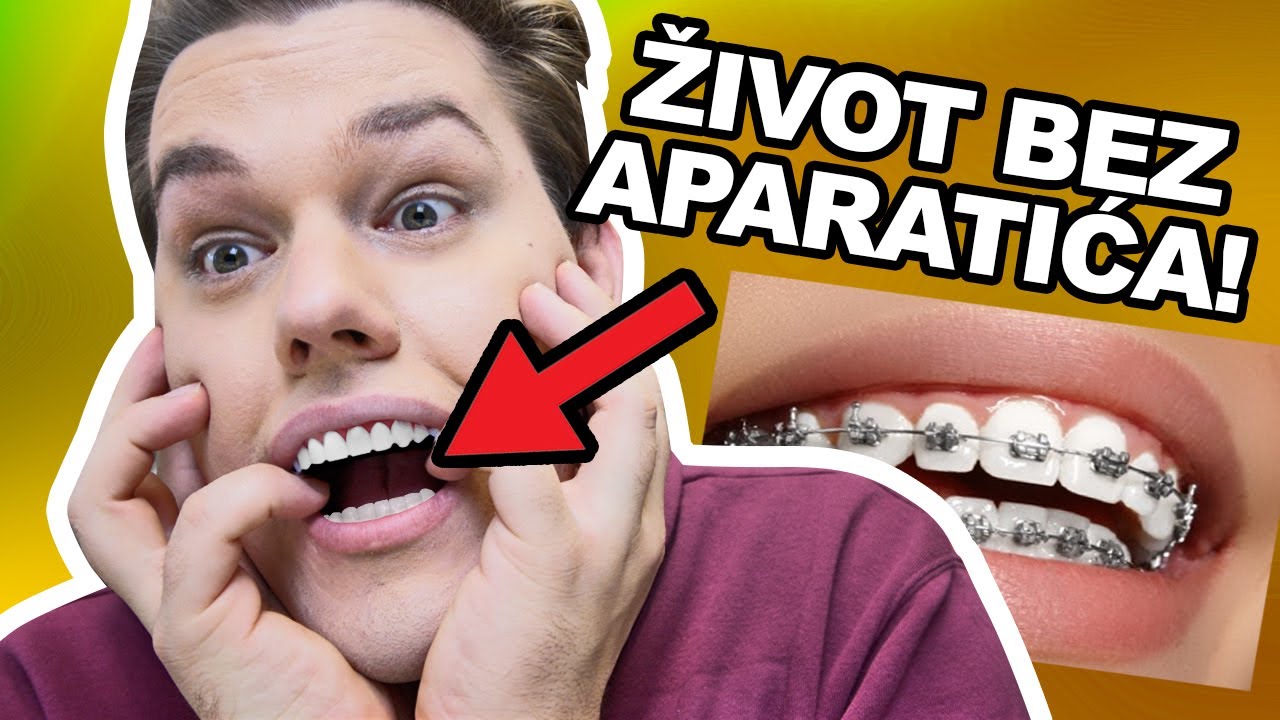 MOJI NOVI ZUBI! *emotivno*