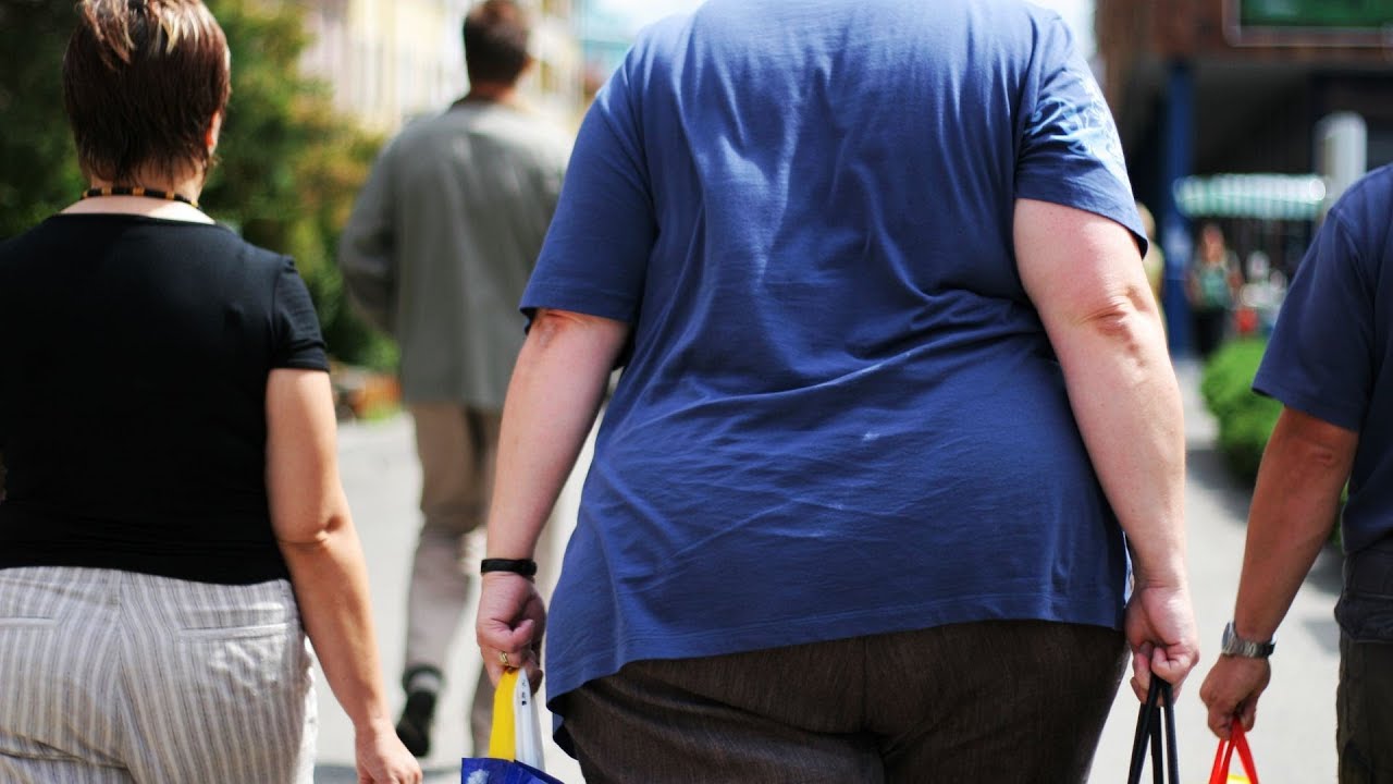 Obesity & Cancer | Obesity