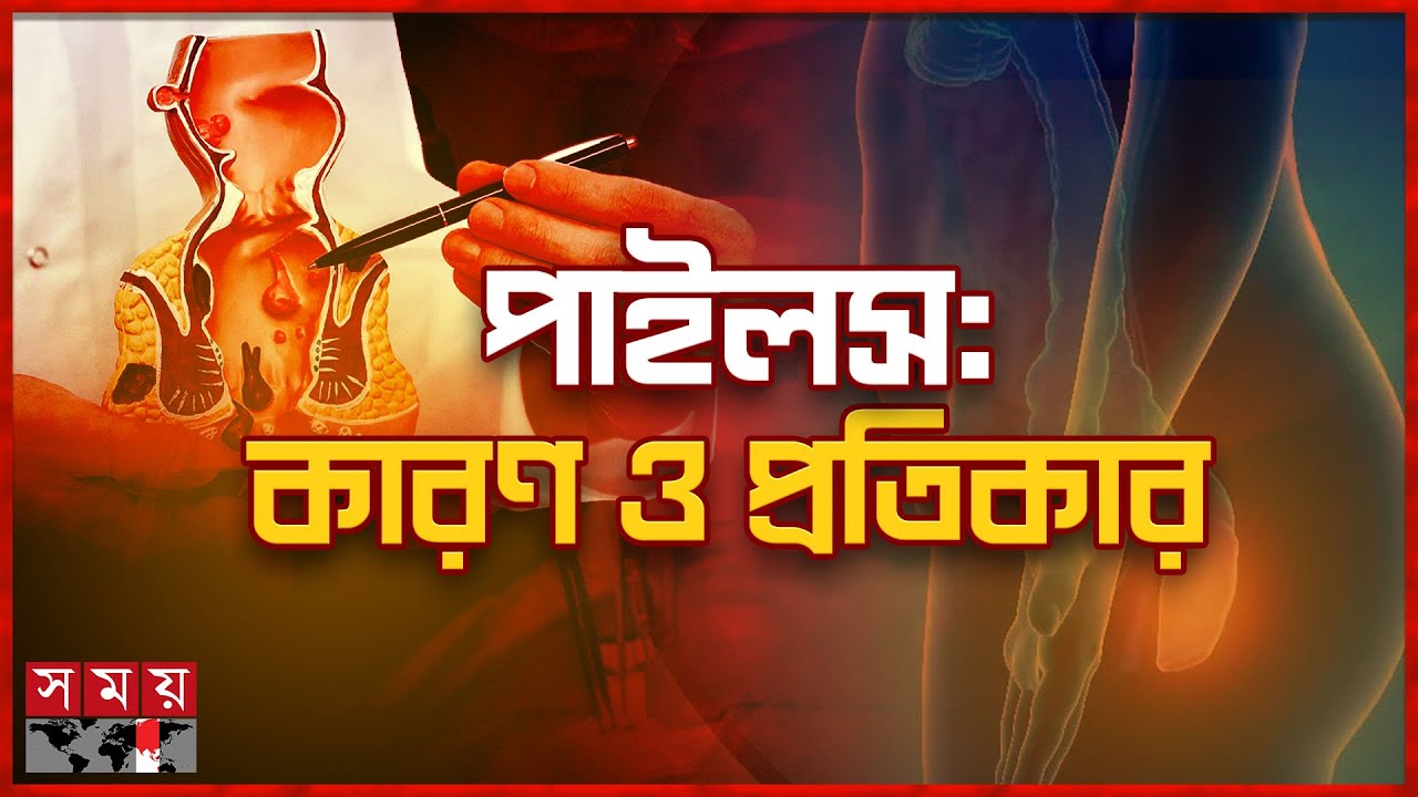 পাইলস: কারণ ও প্রতিকার | Hemorrhoids | Fissure | Fistula | Somoy TV
