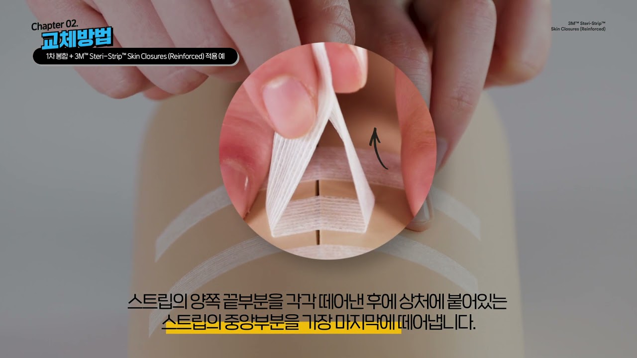 Chapter 2. Steri-Strip™ 교체방법