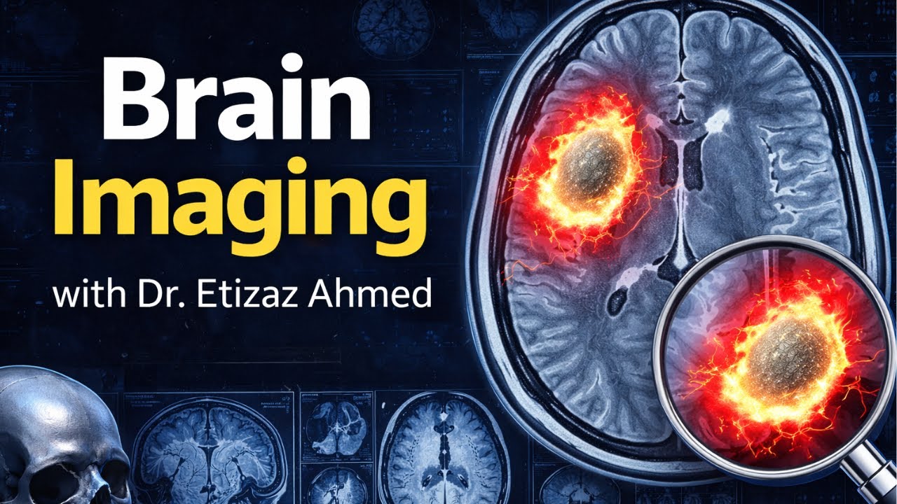 Brain Imaging with Dr  Etizaz Ahmed | The Neurosurgical Case Room