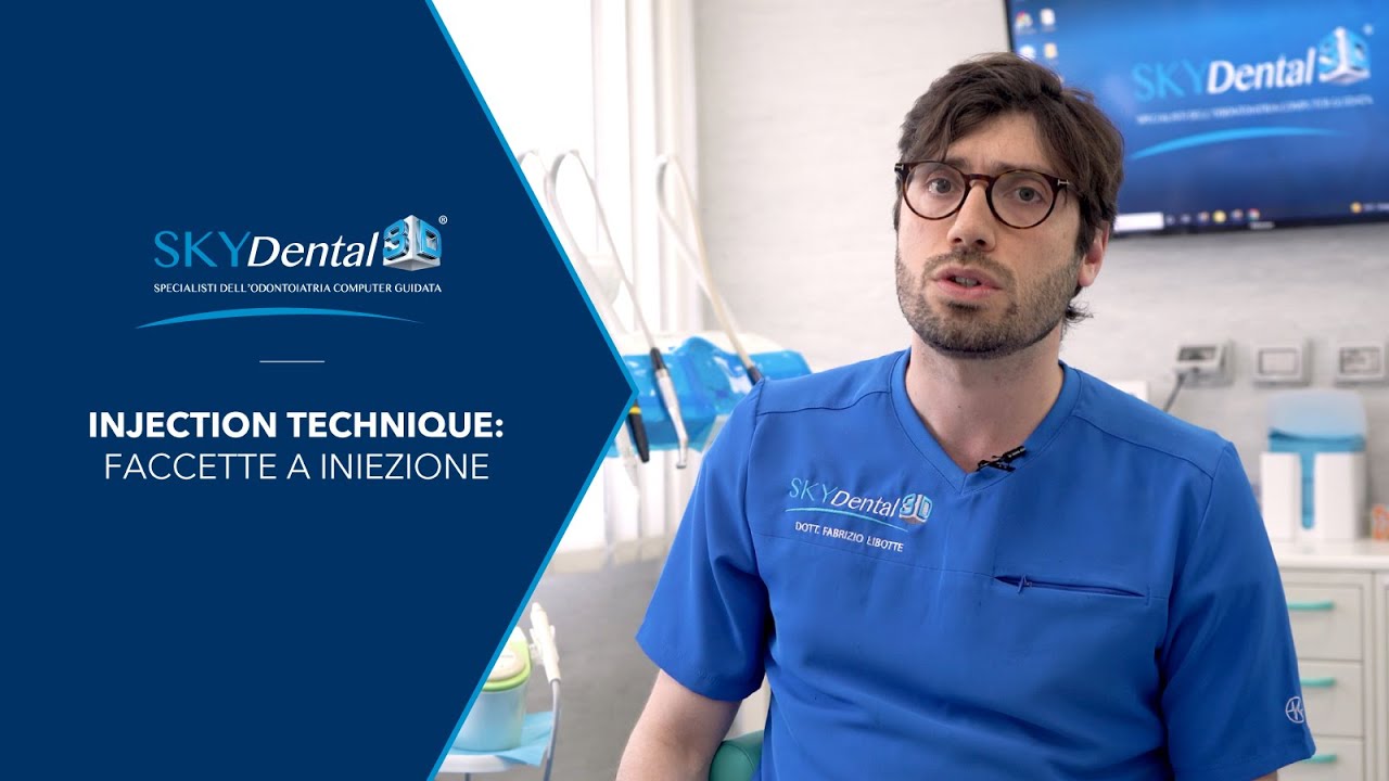 Faccette a iniezione - Inection Technique - SkyDental 3D
