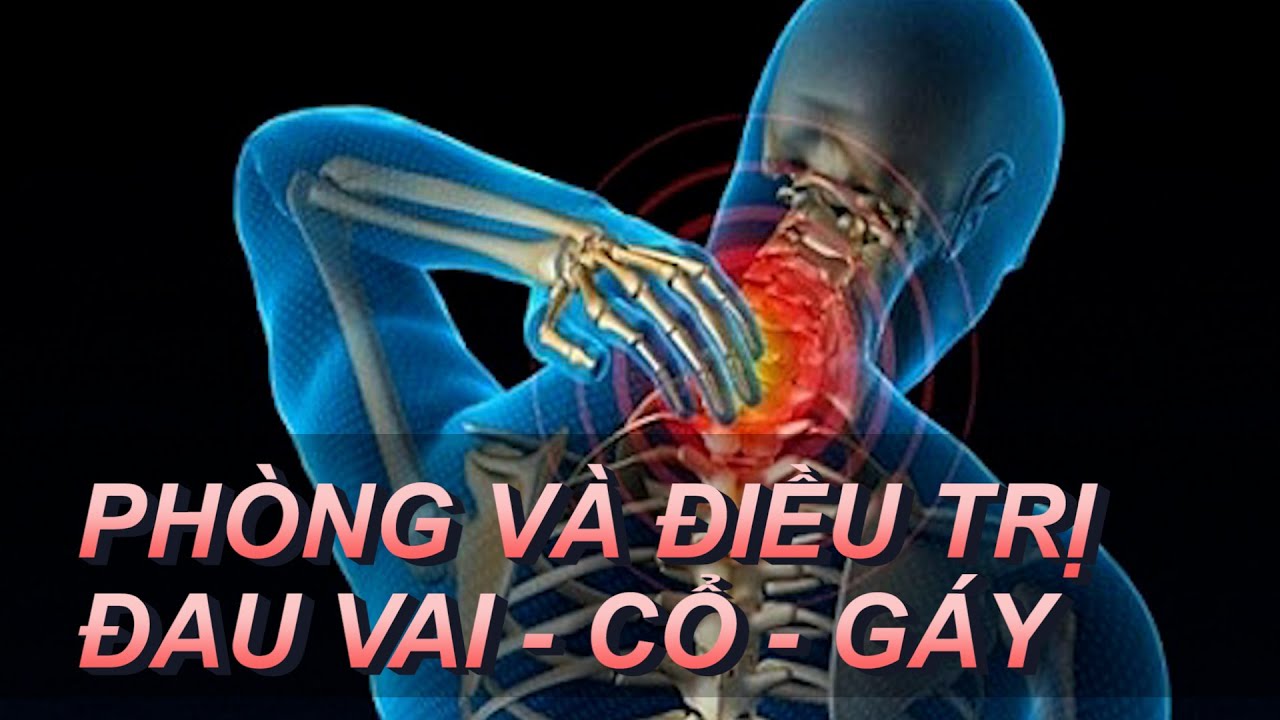 Phòng Chống Và Điều Trị Đau Vai - Cổ - Gáy Nhờ Khí Tâm Yoga Trị Liệu