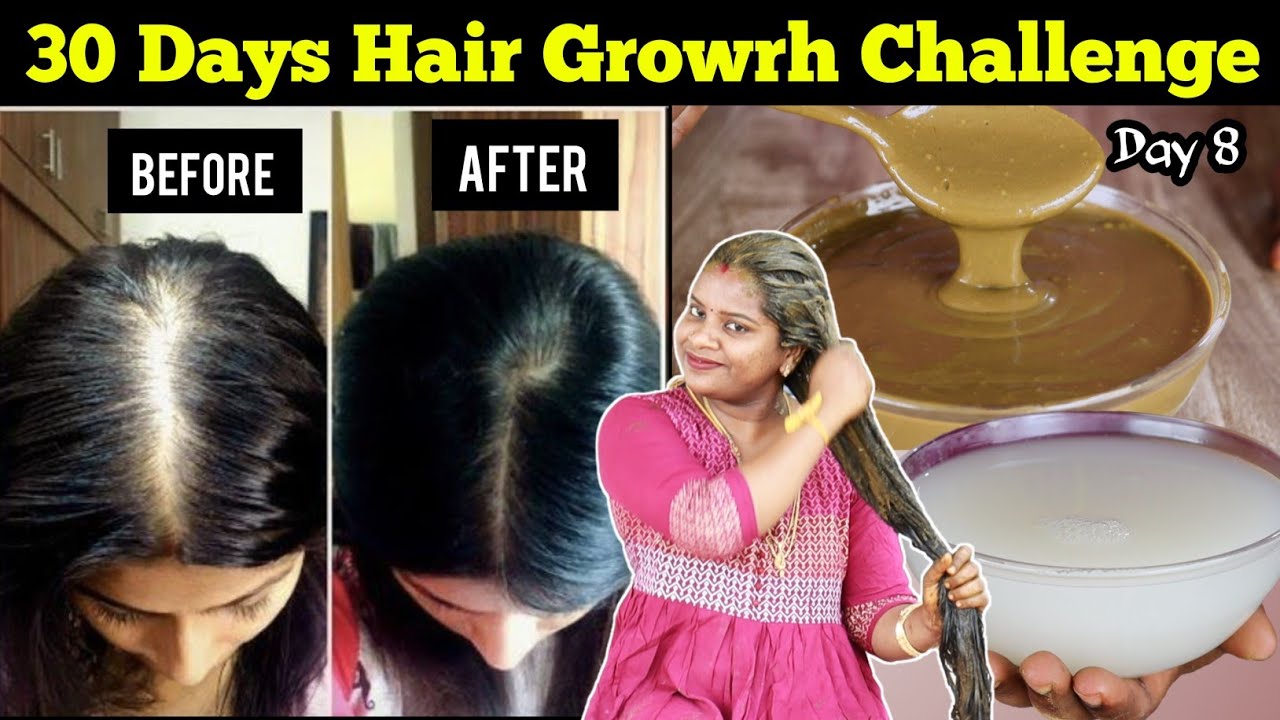 OMG.. 🔥 30 நாளில் வழுக்கை தலையிலும் முடி வளர வைக்கும் Hair growth mask / Hair fall - Jegathees Meena