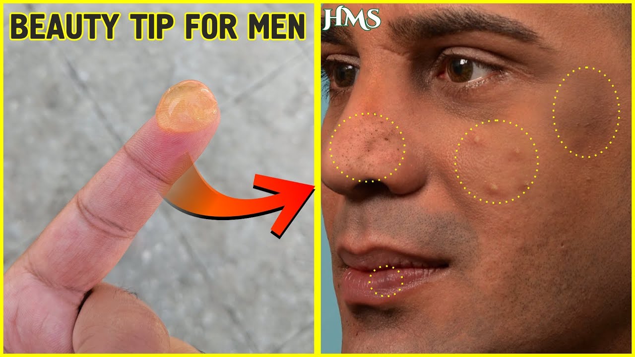 Beauty Tips For Men | पुरुषों की त्वचा को गोरा करने और दाग धब्बे हटाने के असरदार नुस्खे