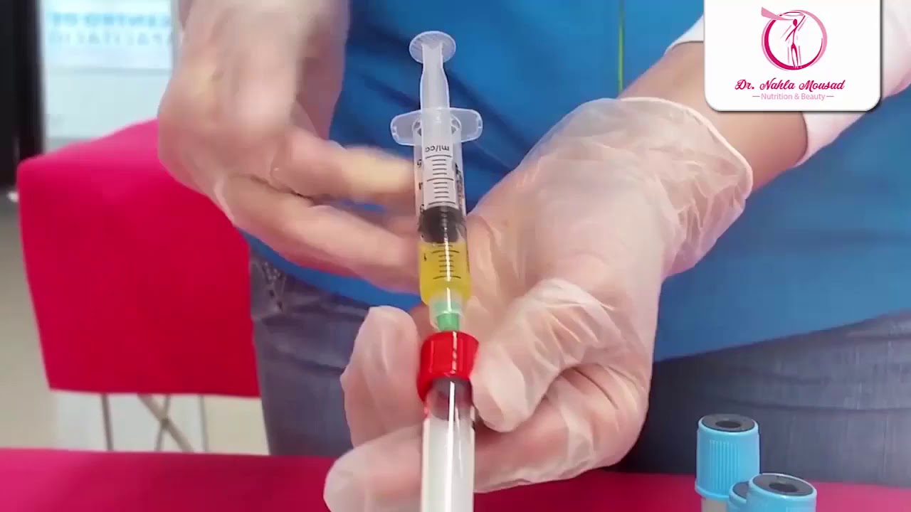 plasma filler (plasma gel) البلازا فيلر ) البلازما جل)