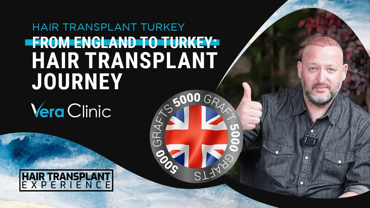 Hair Transplant Turkey Review: From England to Turkey #hairtransplant #hairtransplantturkey
