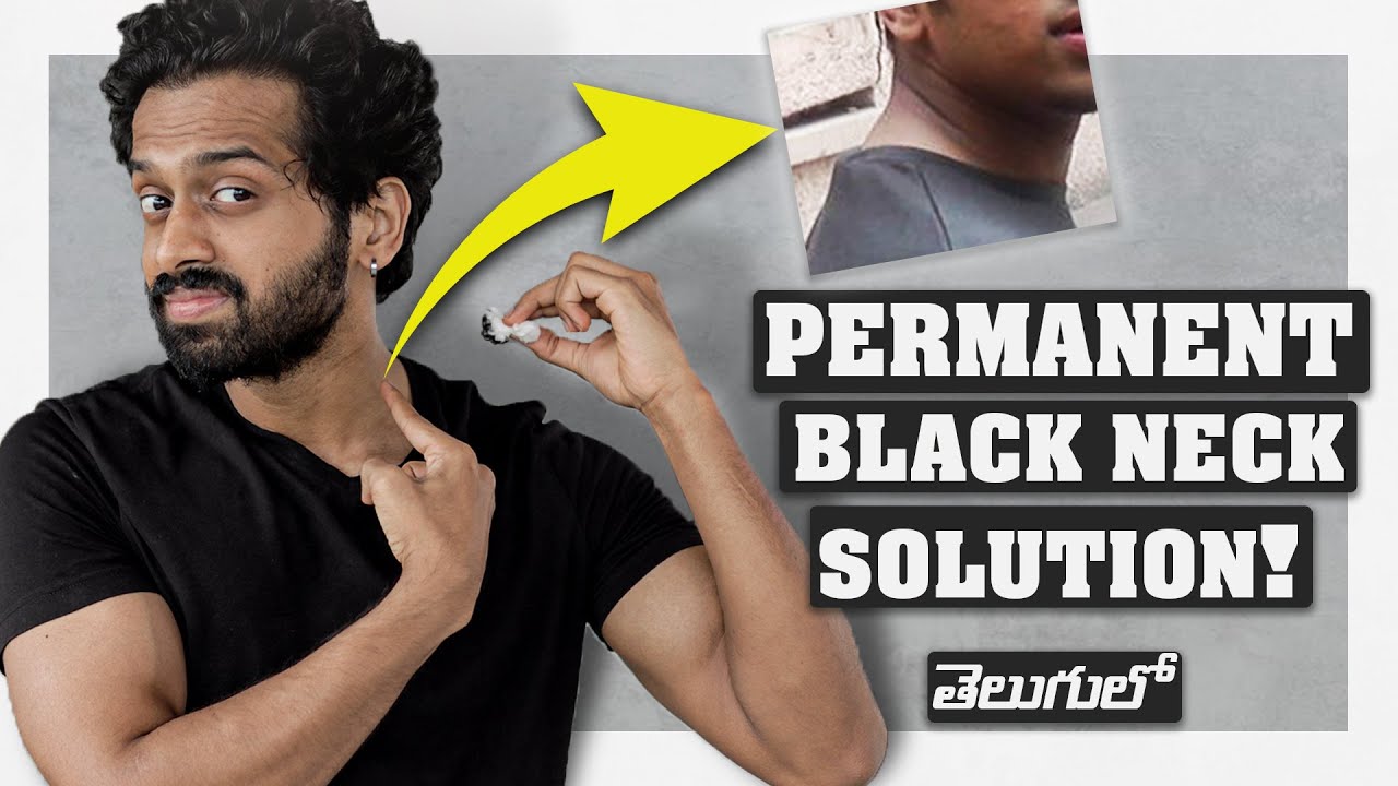 Black Neck REMOVAL Tips For Telugu Guys (5 natural remedies) || Men's Grooming in Telugu || Aye Jude