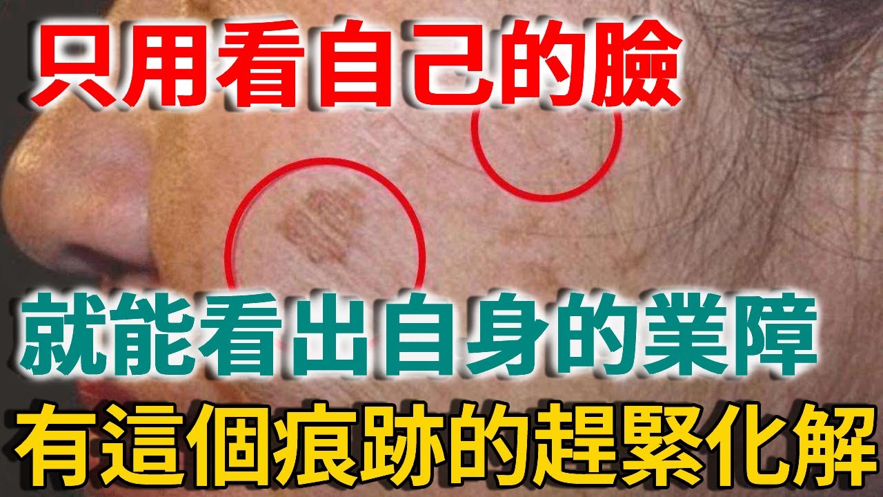 震驚！只用看自己的臉，竟能看出自己的業障重不重，有這個痕跡的趕緊去化解！ | 禪語