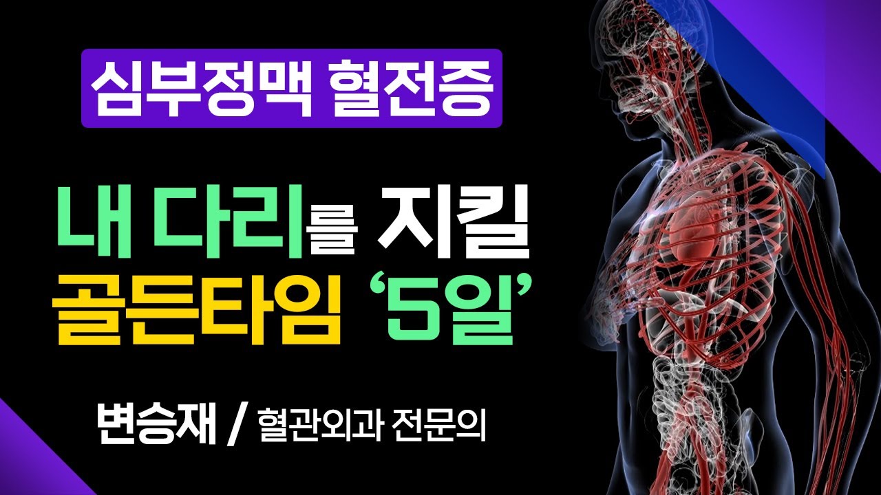 심부정맥 혈전증, 골든타임에 꼭 진찰 받아야 합니다 [ 부산MBC 메디컬다큐365 ] 230814