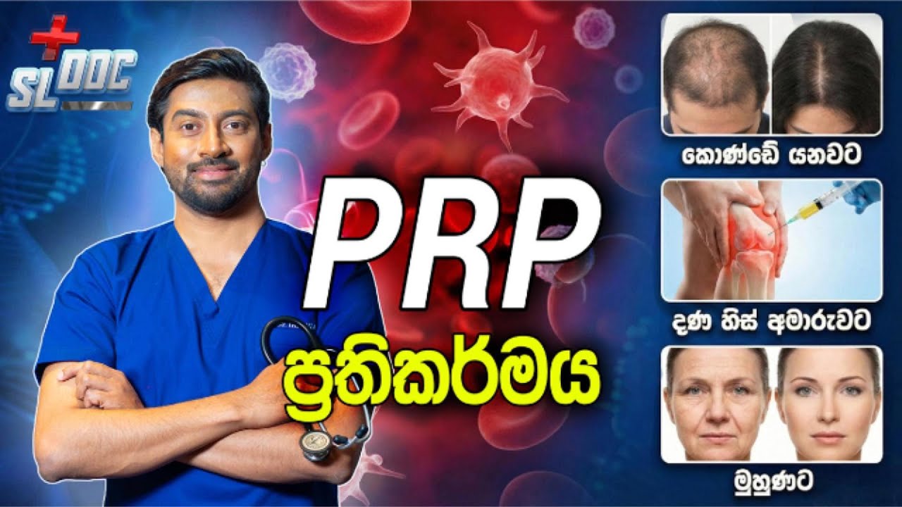 PRP ප්‍රතිකර්මය | Hair Loss, Joint Pain & More | Sinhala | Dr Iranga #prptreatment