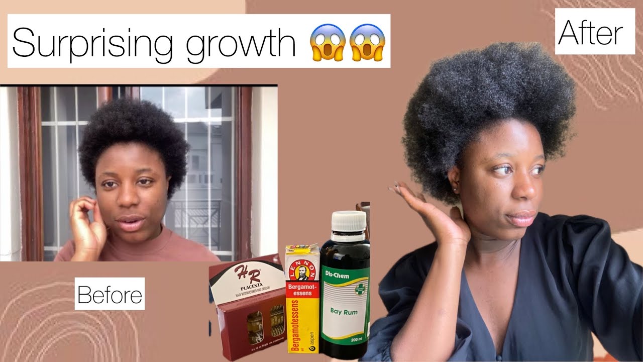 Surprising Results!😱 My Hair Growth Journey with #bayrum #bergamot #placenta | Debiee O
