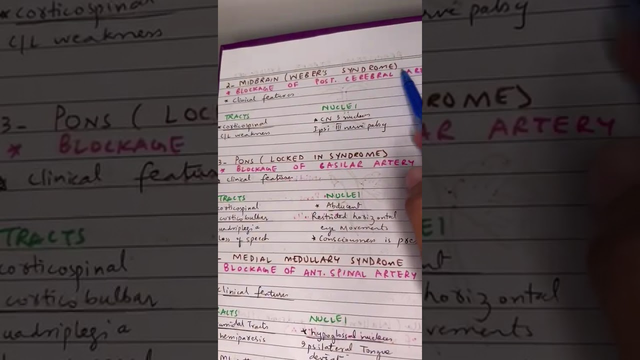 Brainstem stroke syndromes