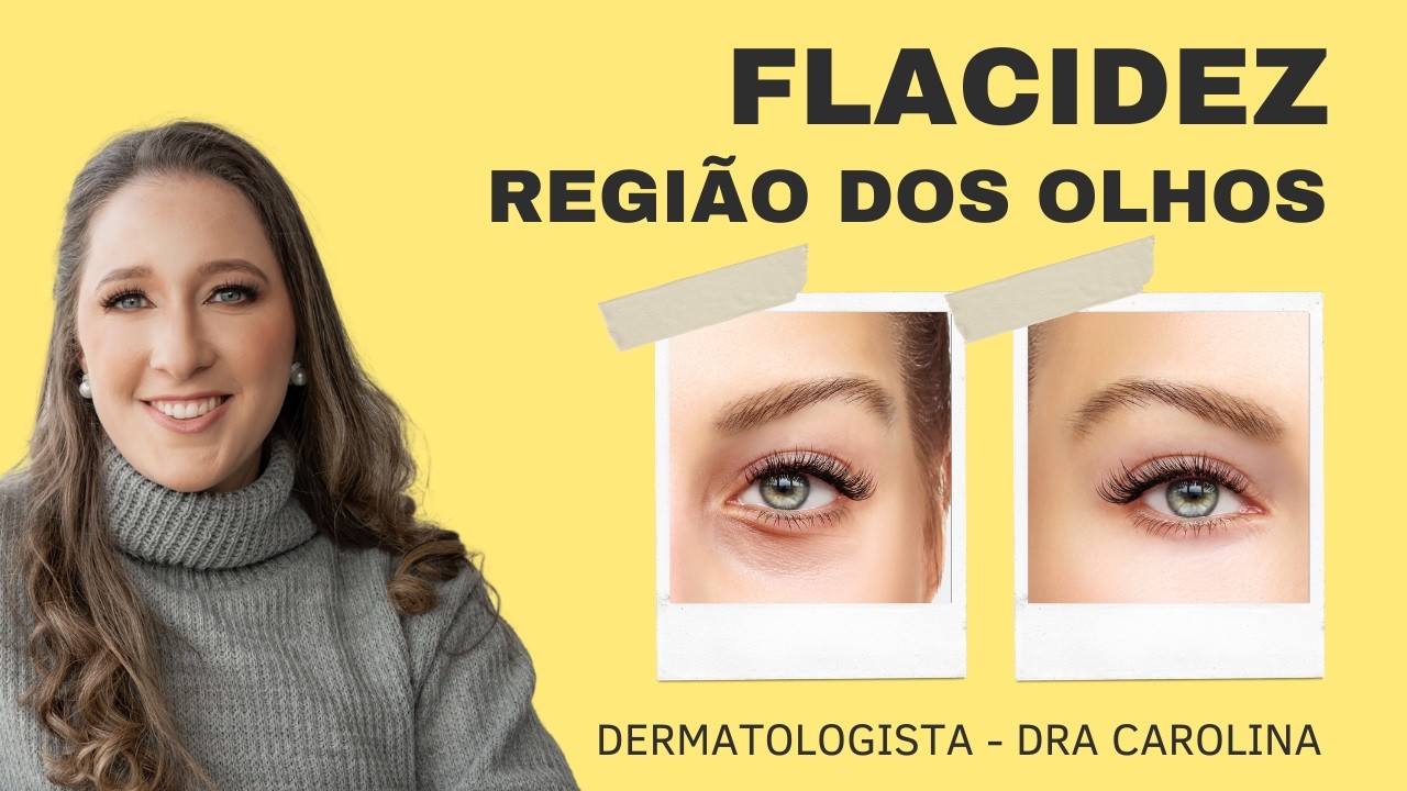 TUDO SOBRE ULTRASSOM MICROFOCADO NA REGIÃO DOS OLHOS - DERMATO DRA CAROLINA