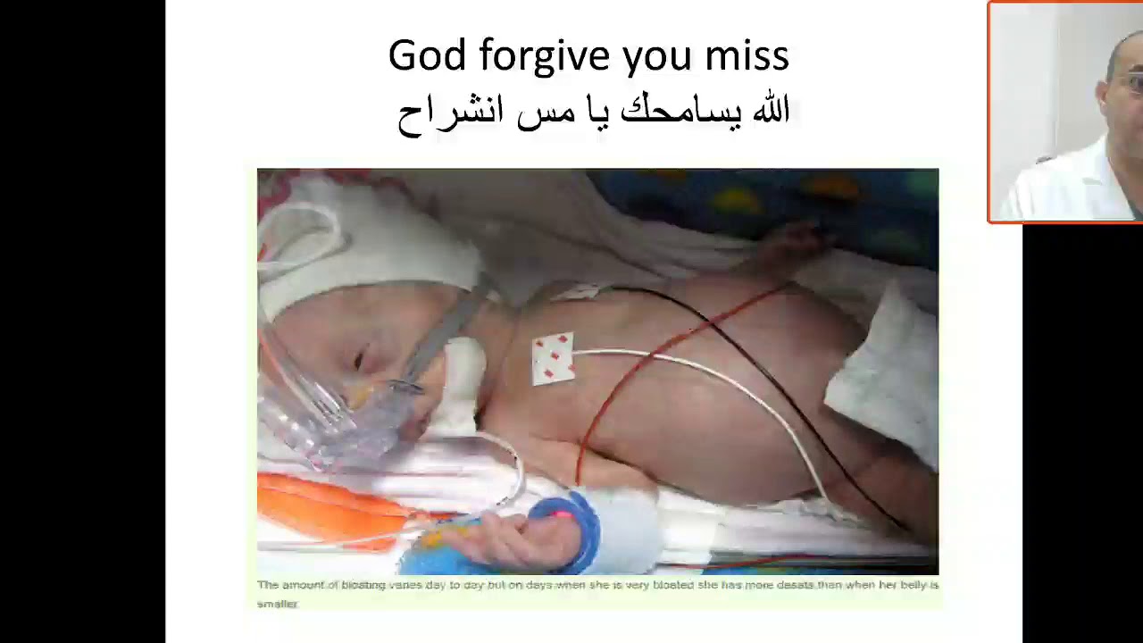 Case 115 common morbidity in NICU CPAP belly syndrome,  الله يسامحك يا مس انشراح Iatrogenic