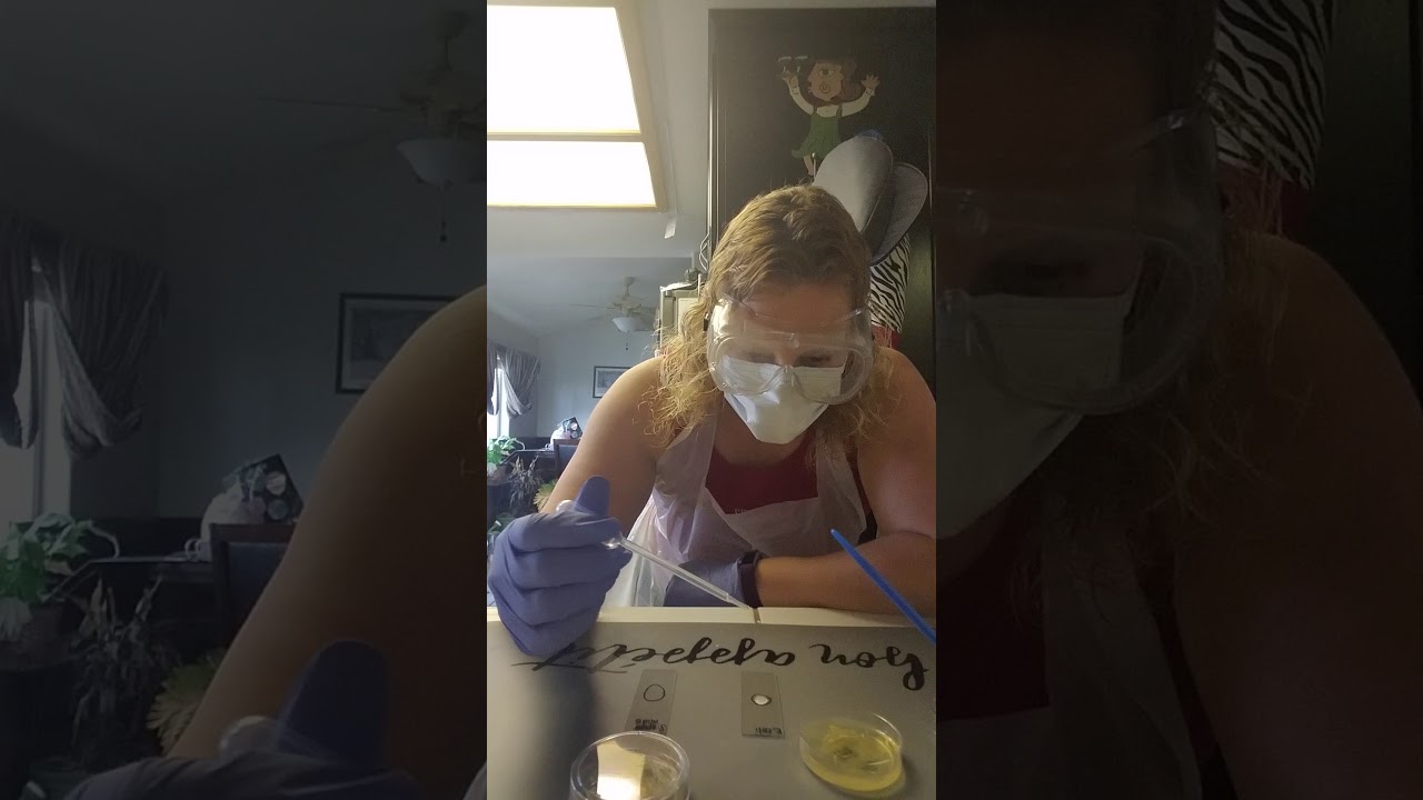 Biochemical testing for microbial identification part 3