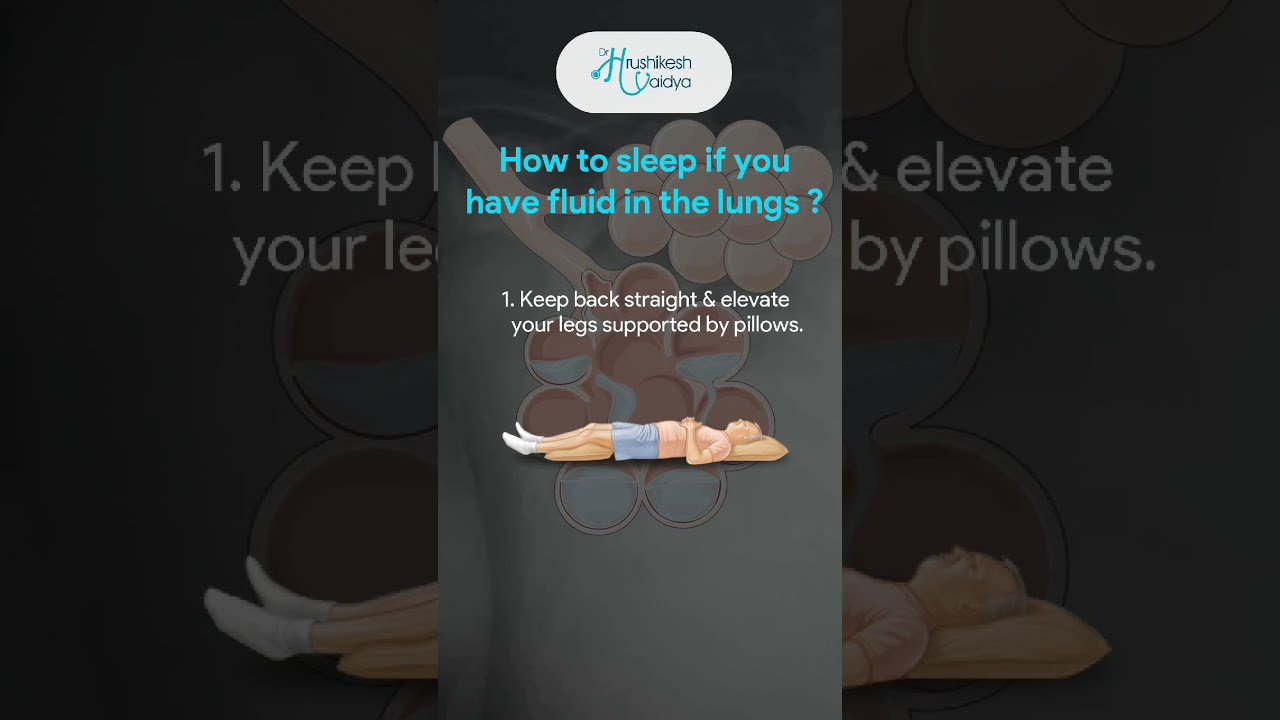 How to sleep if you have fluid in the lungs? | Horizon Prime Hospital | Mumbai | Thane