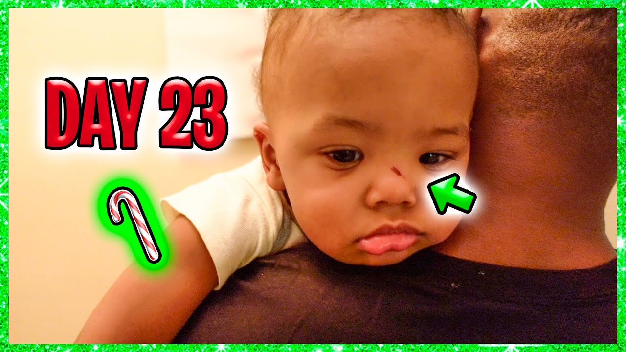This is what happened to baby Caedon's face :( | The Beverly Halls