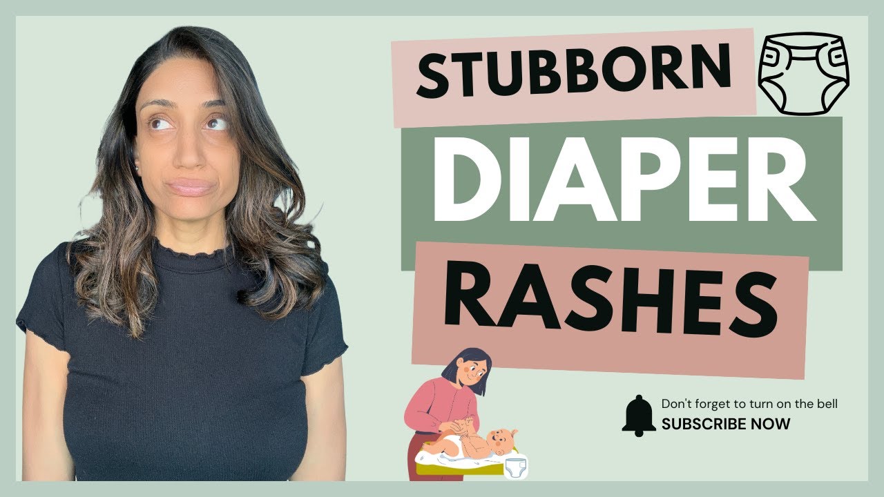 Diaper Rash in Babies: Causes, Best Creams, and Treatment Tips