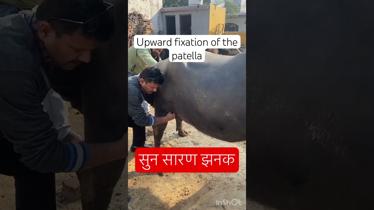 MPD l upward fixation of the patella l dr umar khan