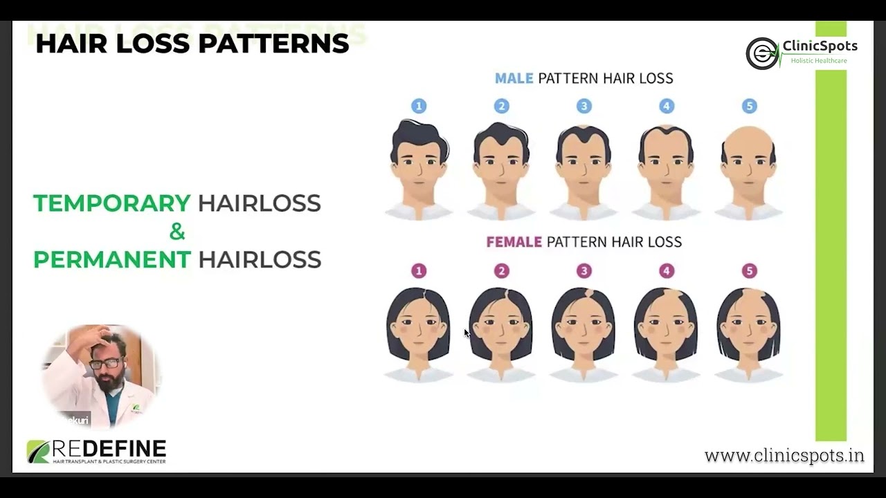 Understanding Hair Fall and Hair Transplant: Expert Insights | ClinicSpots🔍