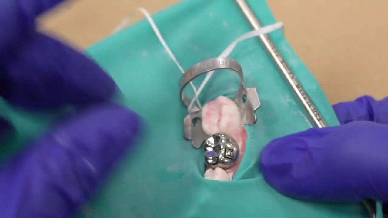 Stainless Steel Crown