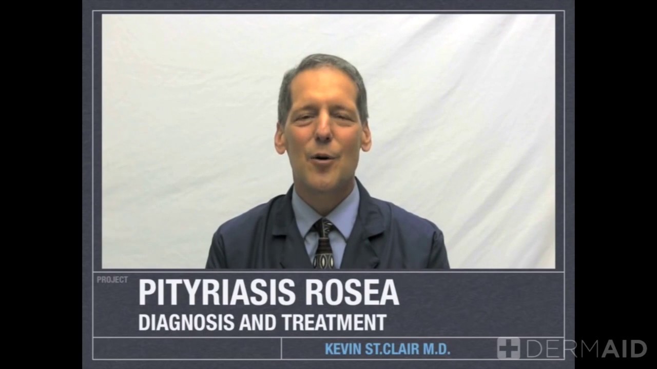 Pityriasis Rosea