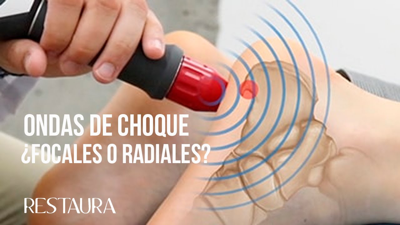 Cuáles son las mejores ondas de choque ¿Focales o radiales?