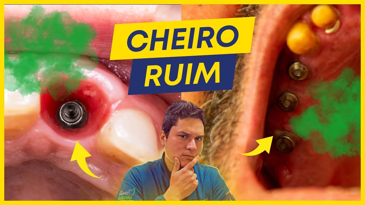 IMPLANTE com CHEIRO RUIM? Dicas INFALÍVEIS para RESOLVER!