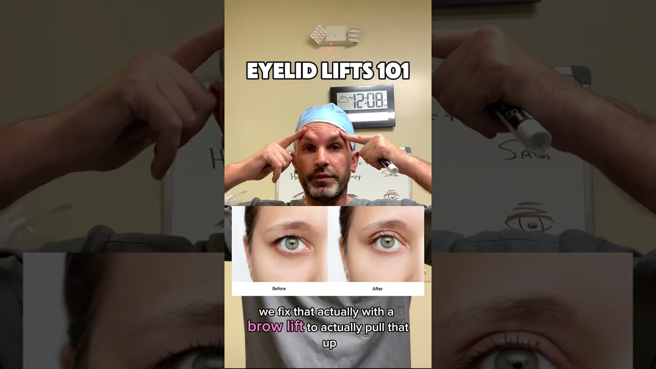 👁️ Hooded vs. Droopy vs. Saggy Eyes: What&rsquo;s the Difference & How We Treat Them!