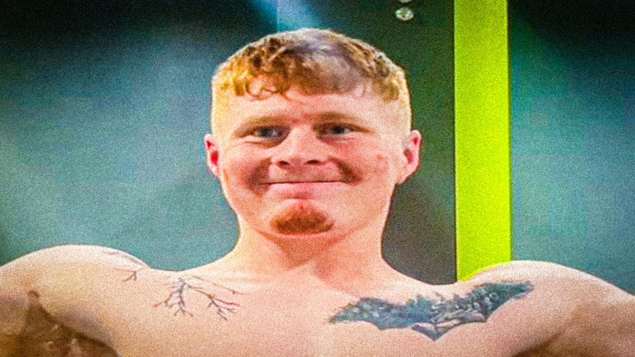 19 Year Old Thought More Gear = More Gains&hellip; Then His Skin EXPLODED