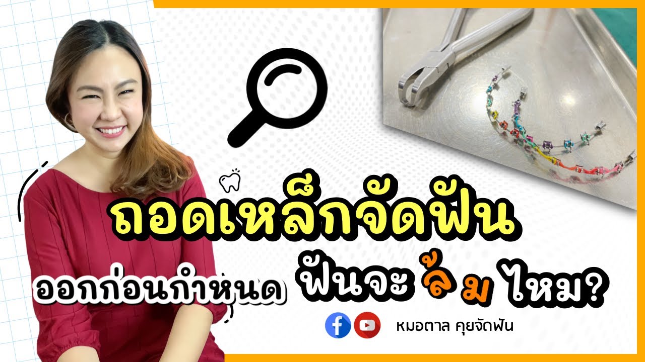 จัดฟันยังไม่เสร็จ อยากถอดเหล็กออกก่อนกำหนด ฟันจะล้มไหม? | หมอตาล ทันตกรรมฟ้าใส | จัดฟันระยอง