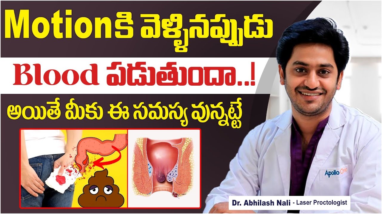 Piles Causes In Telugu || Symptoms Of Piles || How Many Types Of Piles In Telugu || Dr Abhilash Nali