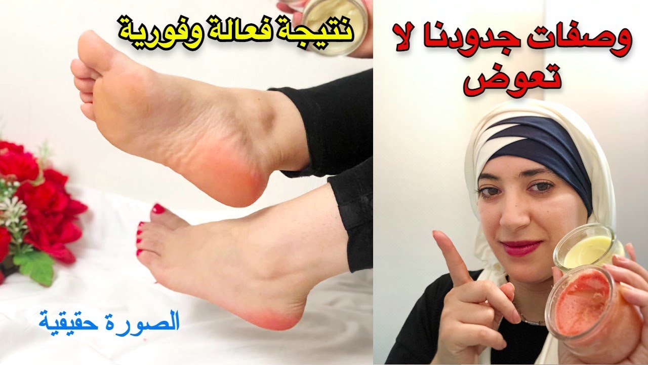 روتيني للعناية بالقدمين مجربة مني شخصيا تقشير/تنعيم/ترطيب وتبييض/ازالة الجلد الميت