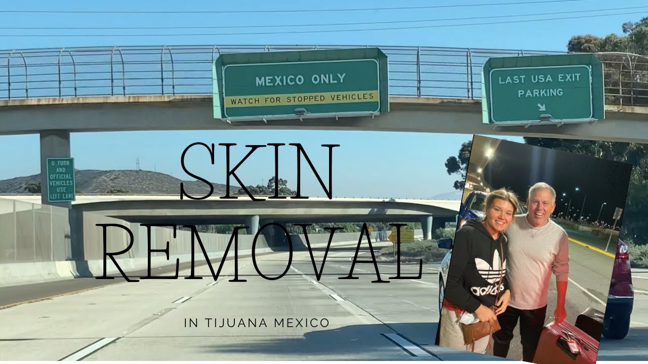 SKIN REMOVAL IN TIJUANA MEXICO-PART 1