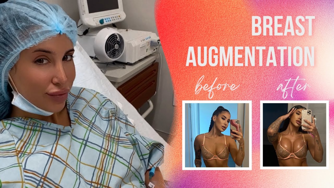 Breast Augmentation Surgery Day + 1 Week Post Op Vlog