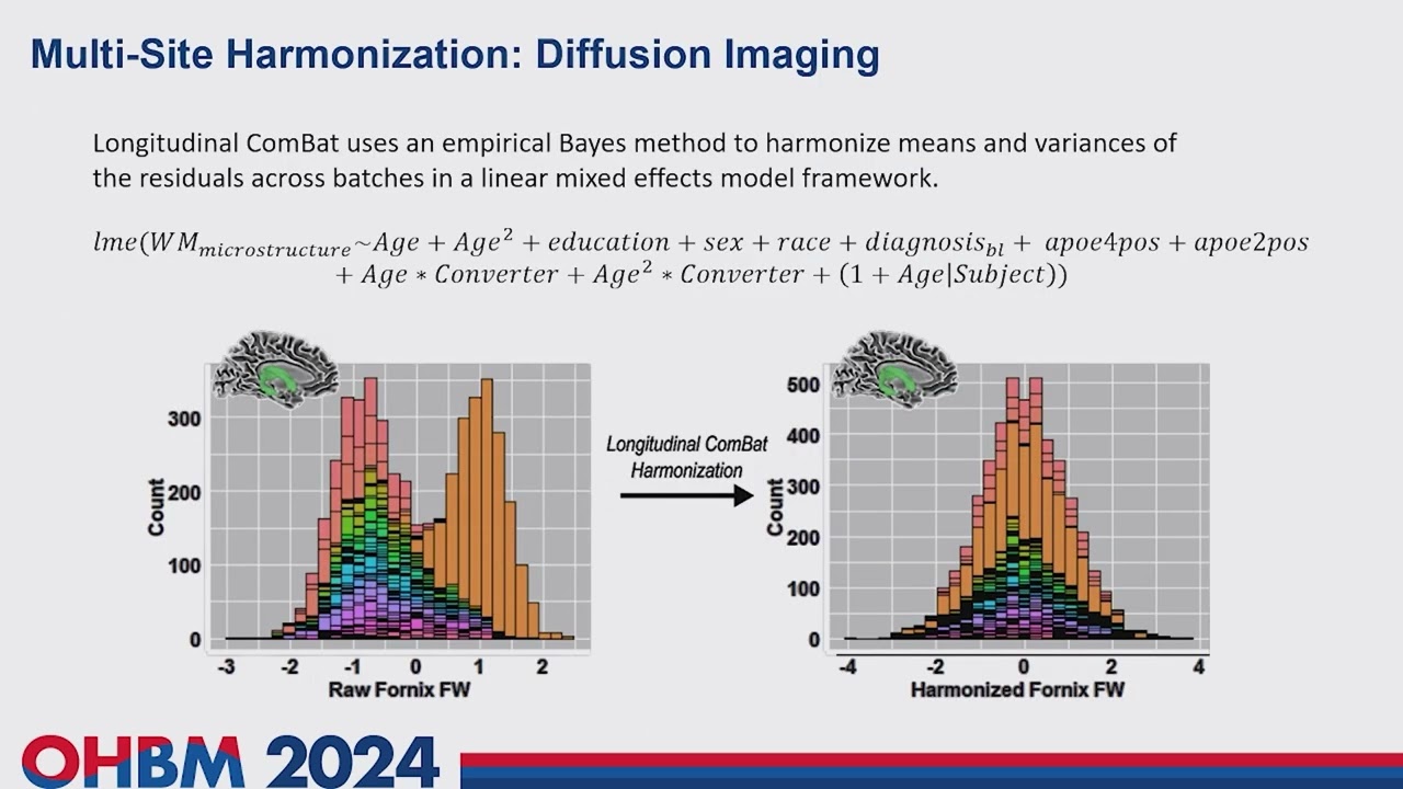 OHBM 2024 | Oral Session | Shannon Risacher |  A comprehensive exploration of longitudinal white m…